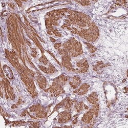MIER3 Antibody, Novus Biologicals 25 &mu;L, Unlabeled:Antibodies, Polyclonal
